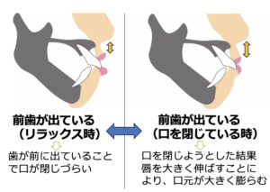 ②ー⑤